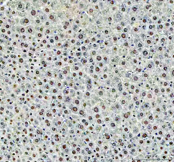 DCK Rabbit Polyclonal Antibody