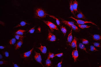 cIAP1/BIRC2 Antibody