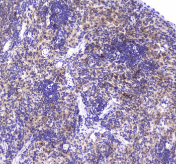 GLO1 Rabbit Polyclonal Antibody