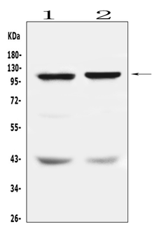 DPYD Rabbit Polyclonal Antibody