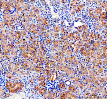 CD2AP Rabbit Polyclonal Antibody