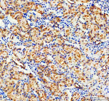 CD2AP Rabbit Polyclonal Antibody