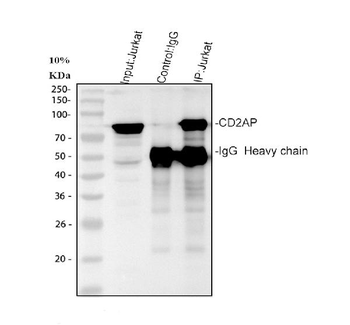 CD2AP Rabbit Polyclonal Antibody