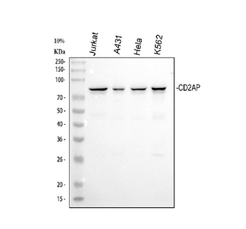 CD2AP Rabbit Polyclonal Antibody