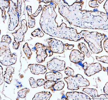 Integrin alpha 5/ITGA5 Rabbit Polyclonal Antibody