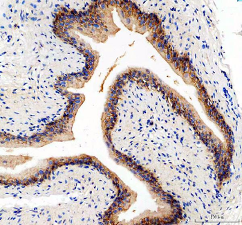 Integrin alpha 5/ITGA5 Rabbit Polyclonal Antibody