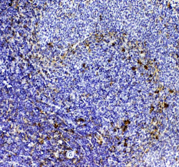 CD8 alpha/Cd8a Rabbit Polyclonal Antibody