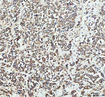 EEA1 Rabbit Polyclonal Antibody