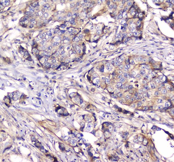 Dynamin 1/DNM1 Rabbit Polyclonal Antibody