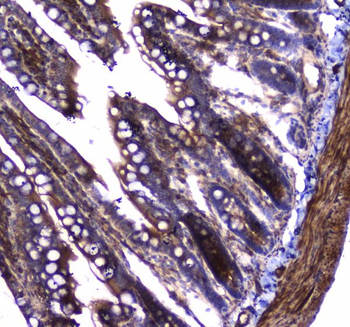 Dynamin 1/DNM1 Rabbit Polyclonal Antibody