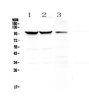 Dynamin 1/DNM1 Rabbit Polyclonal Antibody