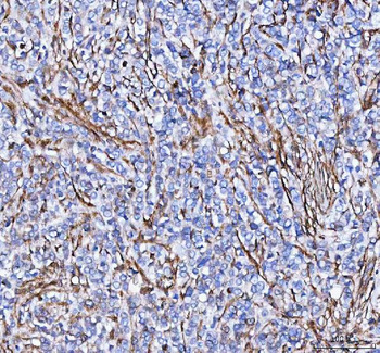 S100A10 Antibody