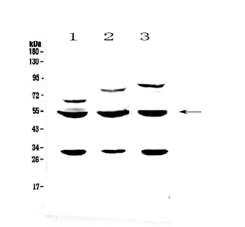 GSK3 alpha/GSK3A Rabbit Polyclonal Antibody