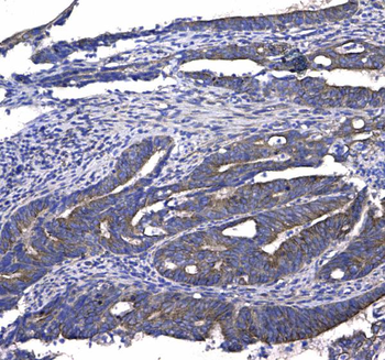 GSTM3 Rabbit Polyclonal Antibody