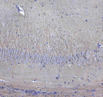 GSTM3 Rabbit Polyclonal Antibody