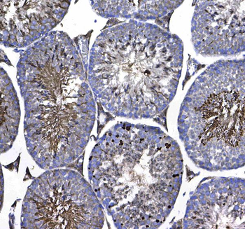 GSTM3 Rabbit Polyclonal Antibody