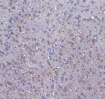 GSTM3 Rabbit Polyclonal Antibody