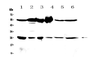 GSTM3 Rabbit Polyclonal Antibody
