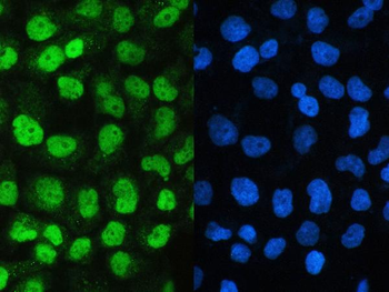SAE2/UBA2 Rabbit Polyclonal Antibody