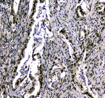 SAE2/UBA2 Rabbit Polyclonal Antibody