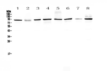 SAE2/UBA2 Rabbit Polyclonal Antibody