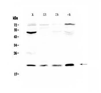 Kallikrein 2/KLK2 Rabbit Polyclonal Antibody