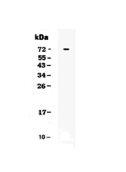 CRLF2 Rabbit Polyclonal Antibody