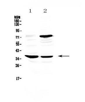 CD23/FCER2 Rabbit Polyclonal Antibody