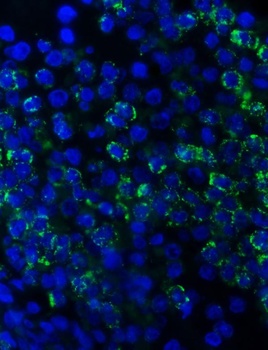 Myeloperoxidase/MPO Rabbit Polyclonal Antibody