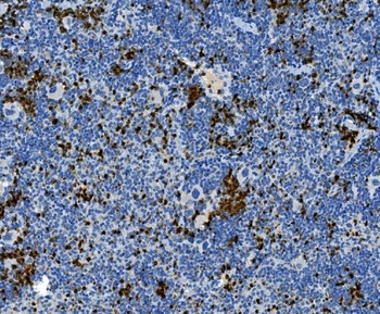 Myeloperoxidase/MPO Rabbit Polyclonal Antibody