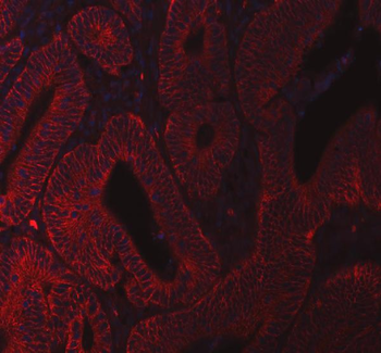 beta Catenin/CTNNB1 Antibody