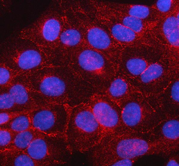 beta Catenin/CTNNB1 Antibody