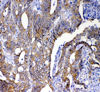 beta Catenin/CTNNB1 Antibody