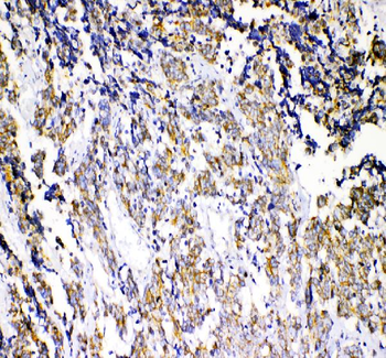 beta Catenin/CTNNB1 Antibody