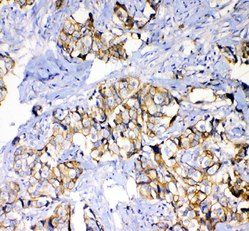 beta Catenin/CTNNB1 Antibody