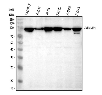 beta Catenin/CTNNB1 Antibody