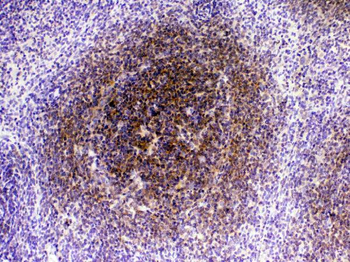 CTLA4 Rabbit Polyclonal Antibody