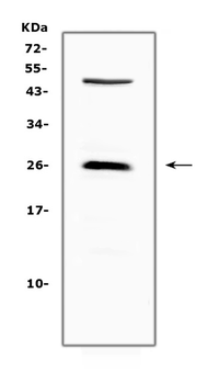 CTLA4 Rabbit Polyclonal Antibody