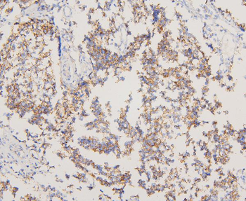 EGFR Rabbit Polyclonal Antibody