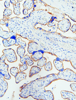 EGFR Rabbit Polyclonal Antibody
