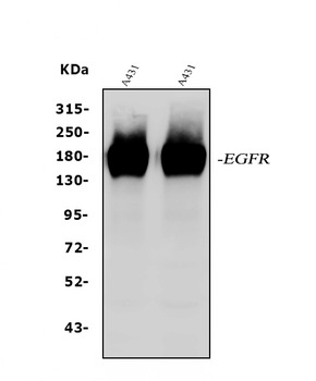 EGFR Rabbit Polyclonal Antibody