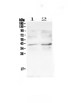 CCR5 Rabbit Polyclonal Antibody