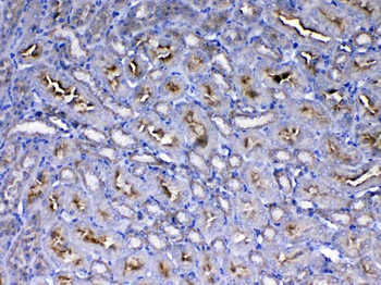 IGF1 Receptor/Igf1r Rabbit Polyclonal Antibody