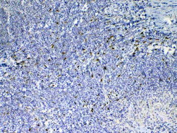 IL33 Rabbit Polyclonal Antibody