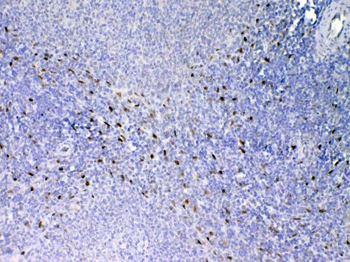 IL33 Rabbit Polyclonal Antibody