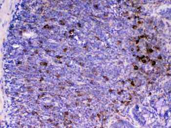 CD14 Rabbit Polyclonal Antibody