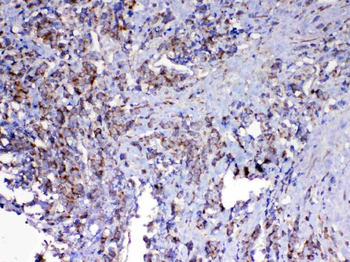 MAVS Rabbit Polyclonal Antibody