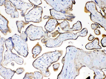 MUC1 Rabbit Polyclonal Antibody