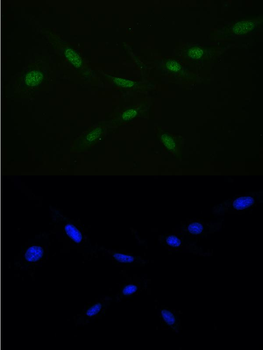 Ran Rabbit Polyclonal Antibody