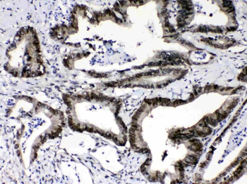 Ran Rabbit Polyclonal Antibody
